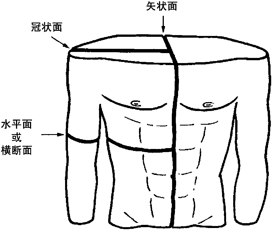 平面與畸形